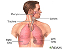 Lung transplant - series