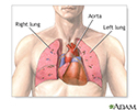 Heart-lung transplant - series - Normal anatomy