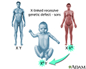 X-linked recessive genetic defects - how boys are affected