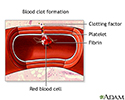 Blood clot formation