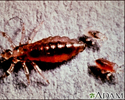 Body louse, female and larvae