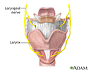 Laryngeal nerve damage