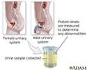 Protein urine test